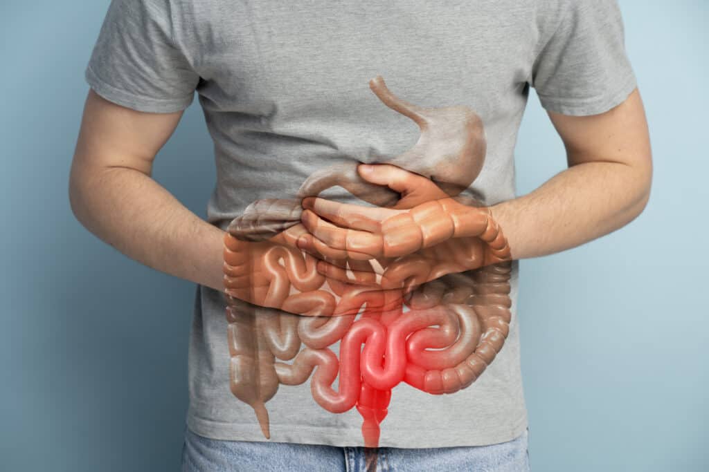 Aspirin Can Prevent Intestinal Cancer